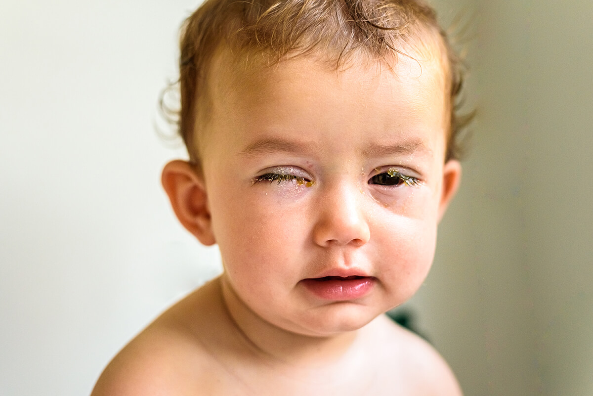 Małe dziecko - Choroby oczu u dzieci - jak je rozpoznać