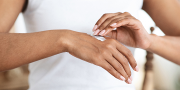 Egzema na dłoniach: przyczyny, objawy, skuteczne leczenie